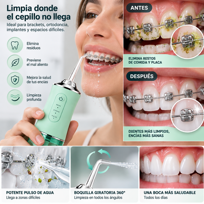 FreshSmile Pro™ – Irrigador Bucal de Limpieza Profunda